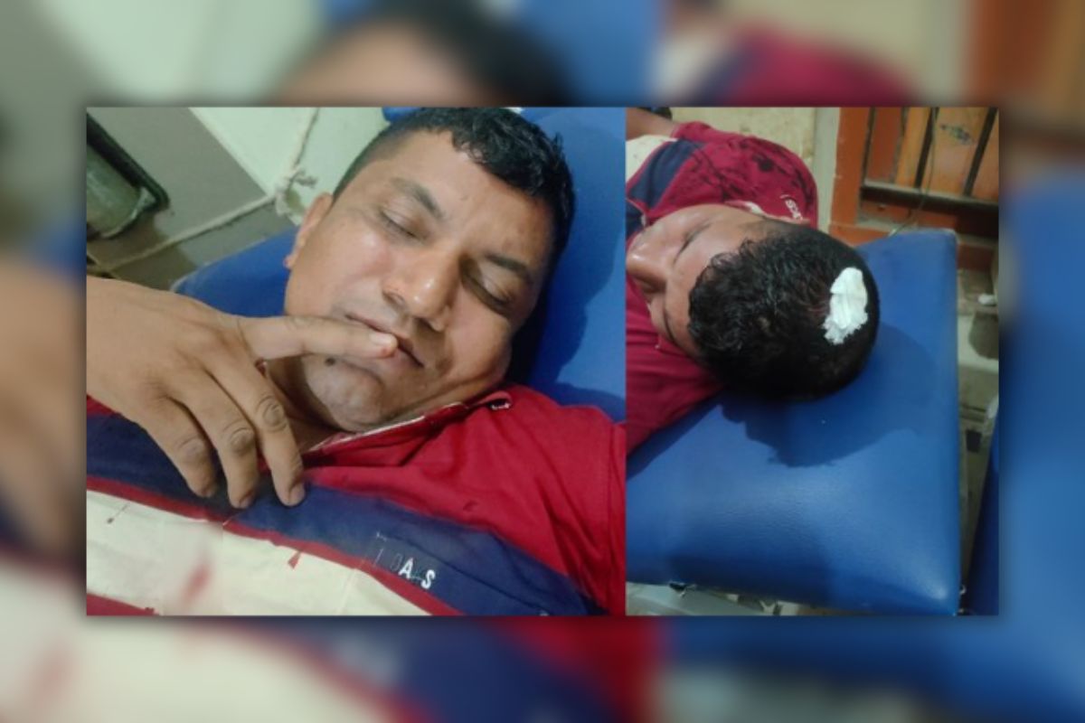 পুলিশকে হাতুড়ি দিয়ে পেটালেন আসামি
