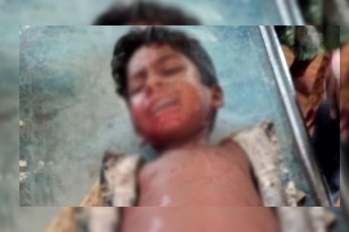 বো’মা বল বানিয়ে খেলার সময় বি’স্ফো’রণ, নি’হত এক
