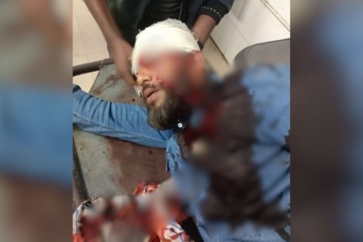 এবার প্রকাশ্যে এনসিপি নেতা মোতালেব গুলিবিদ্ধ