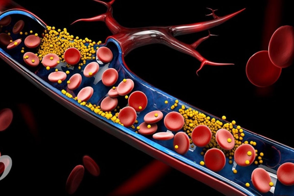 প্রাকৃতিক উপায়ে কোলেস্টেরল কমানোর কার্যকর উপায়