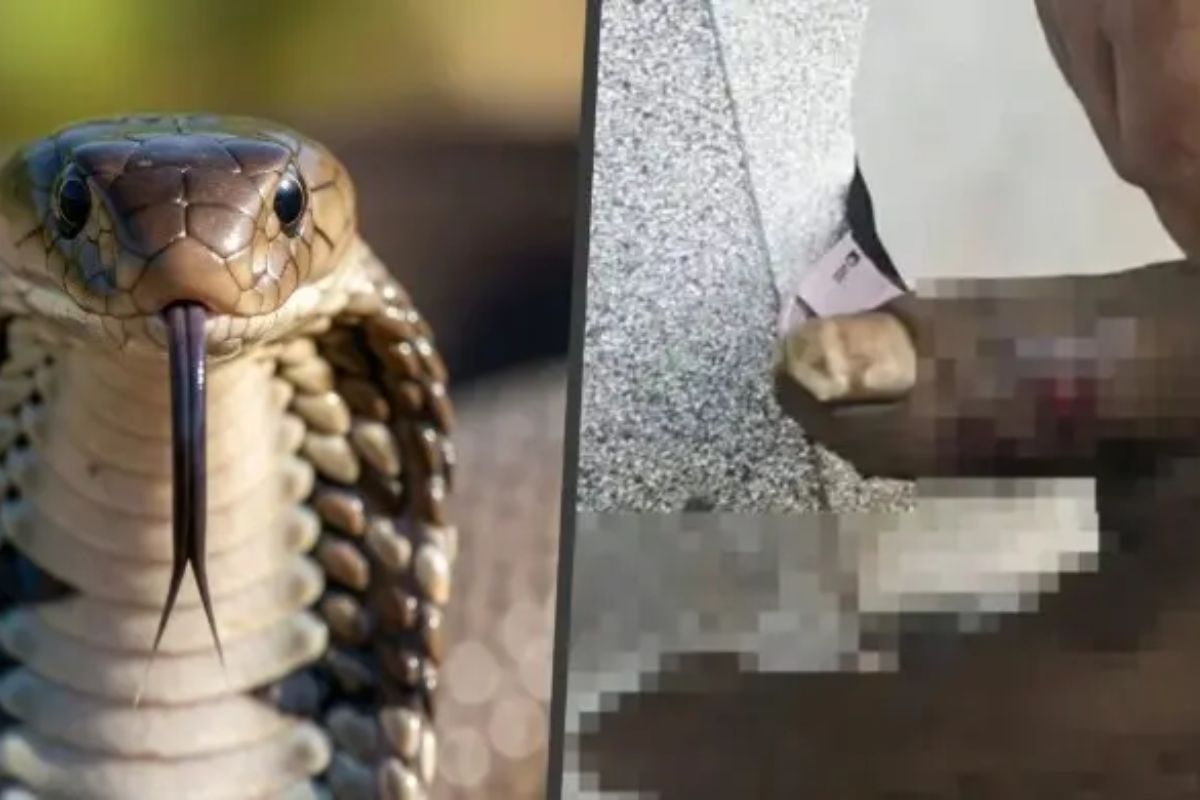 স্বামীর শরীর থেকে বিষ টানতে গিয়ে নিজেই হাসপাতালে স্ত্রী