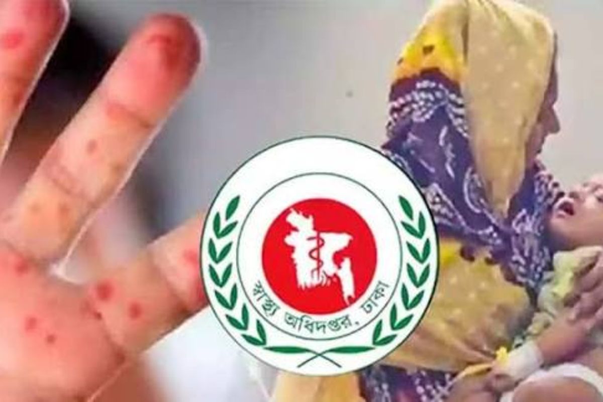 ২৪ ঘণ্টায় হামে ৩ জনের মৃ/ত্যু