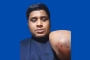 হামলার শিকার হাসনাত আব্দুল্লাহ