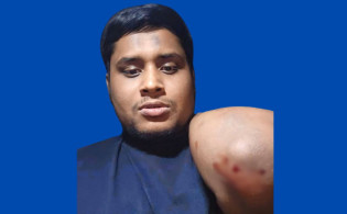 হামলার শিকার হাসনাত আব্দুল্লাহ