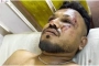 ভারতের বিমান বিধ্বস্তে বেঁচে গেলেন এক যুবক
