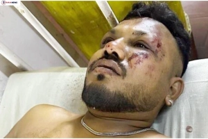 ভারতের বিমান বিধ্বস্তে বেঁচে গেলেন এক যুবক