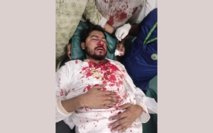 গুরুতর আহত ডাকসুর সাবেক ভিপি নুর