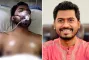নুরুল হকের মাথা-মুখের আঘাত, বিদেশি চিকিৎসা অনিবার্য