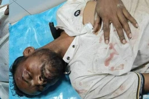 দুর্বৃত্তদের হাম'লার শিকার হিরো আলম
