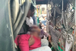 টেকনাফে গু-লিবিদ্ধ শিশু আফনান আইসিইউতে ভর্তি