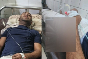 শাহবাগে লাঠিচার্জে আহত রনির অবস্থা স্থিতিশীল