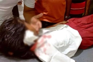 ক্লাস চলাকালে ফ্যান খুলে পড়ে দুই শিক্ষার্থী আহত