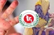 হাম ও সন্দেহে ২৫১ শিশুর মৃত্যু