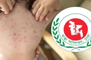 হামে ২৪ ঘণ্টায় ৭ শিশুর মৃত্যু