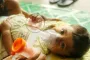 ২৪ ঘণ্টায় হামে আরও ৩ শিশুর মৃত্যু